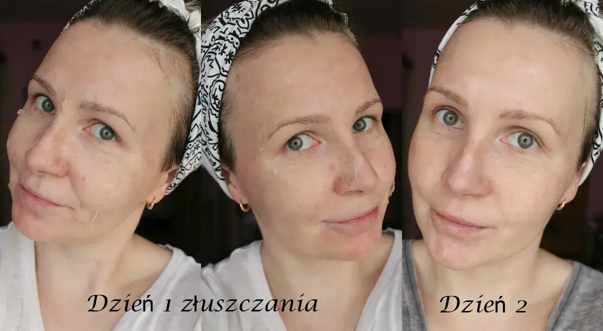 Zdjęcie Peeling przed czy po saunie? Jak uniknąć błędów i zadbać o skórę